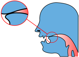 Depiction of the obstruction involved in the articulation of the alveolar plosives [t] and [d].