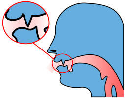 Impeding of airflow during articulation of labio-dental fricatives [f] and [v].